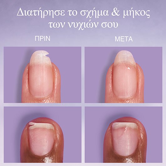 break fix θεραπεία για νύχια